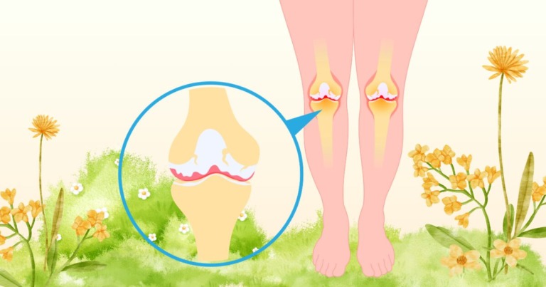 갱년기 무릎 통증