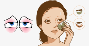 🌟눈 붓기! 한의사가 알려주는 5분 완벽 해결법 + 피로 제로 비법