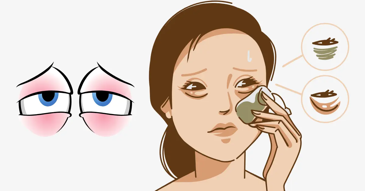 눈 붓기