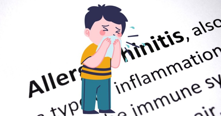 알레르기 비염