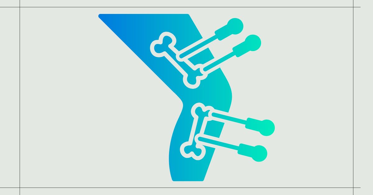 매선치료 유지기간