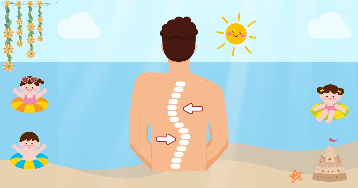 척추 측만증